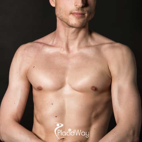 5 Key Differences in Male Breast Reduction (Gynecomastia) Surgery in Mexico vs US